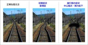 ohan1